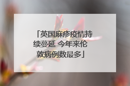 英国麻疹疫情持续蔓延 今年来伦敦病例数最多